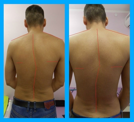 Форма тела — ваш банковский счёт здоровья