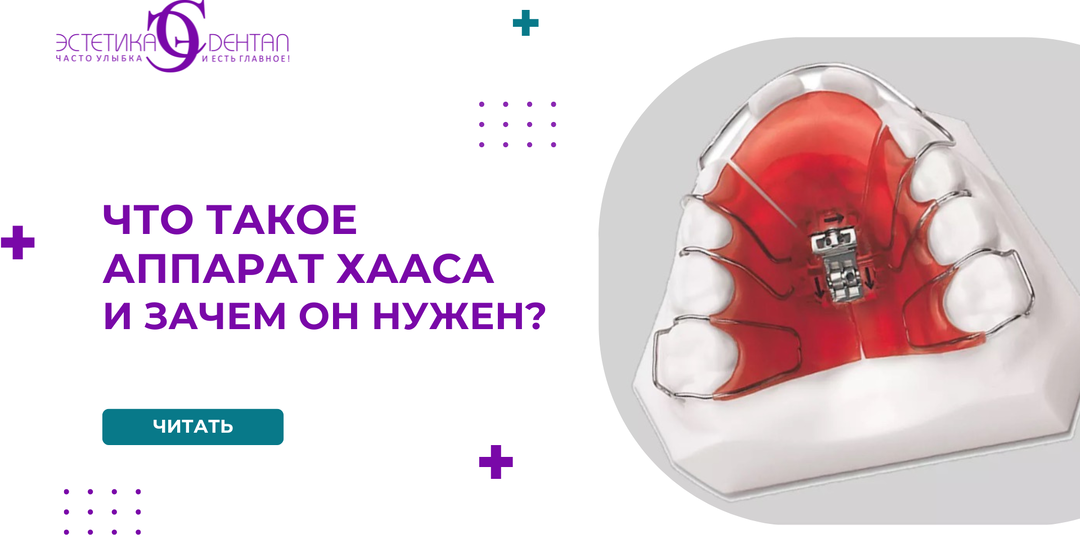 Что такое аппарат Хааса и зачем он нужен?