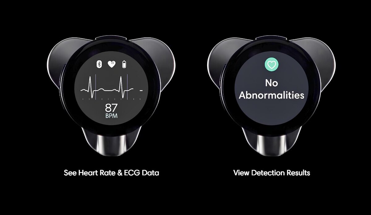 Фото: Eko Health