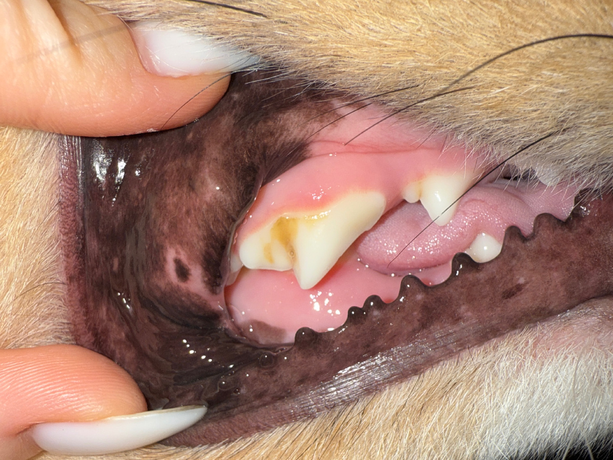 зубной камень. все начинается с вот такого незначительного налета. его еще можно убрать гелями, без санации полости рта под наркозом. 