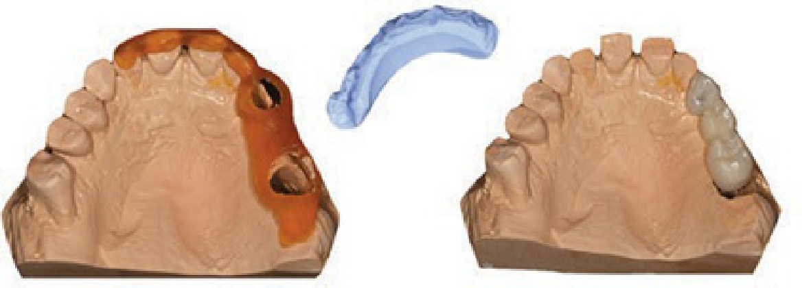 Рис. 1. Рабочая модель с трансферным ключом и каналами доступа для переноса.