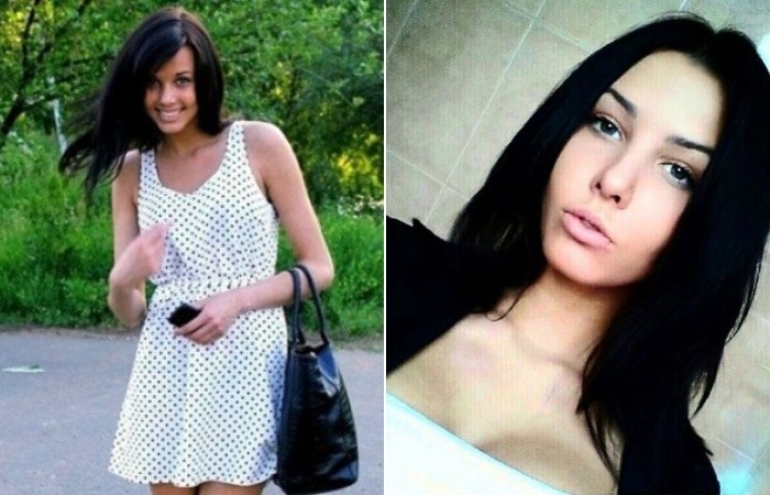 Анастасия Решетова до пластики.