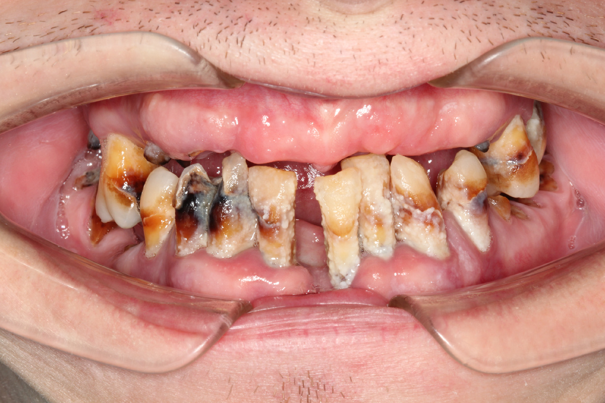 Пациент с отягощенным анамнезом.История со счастливым финалом.