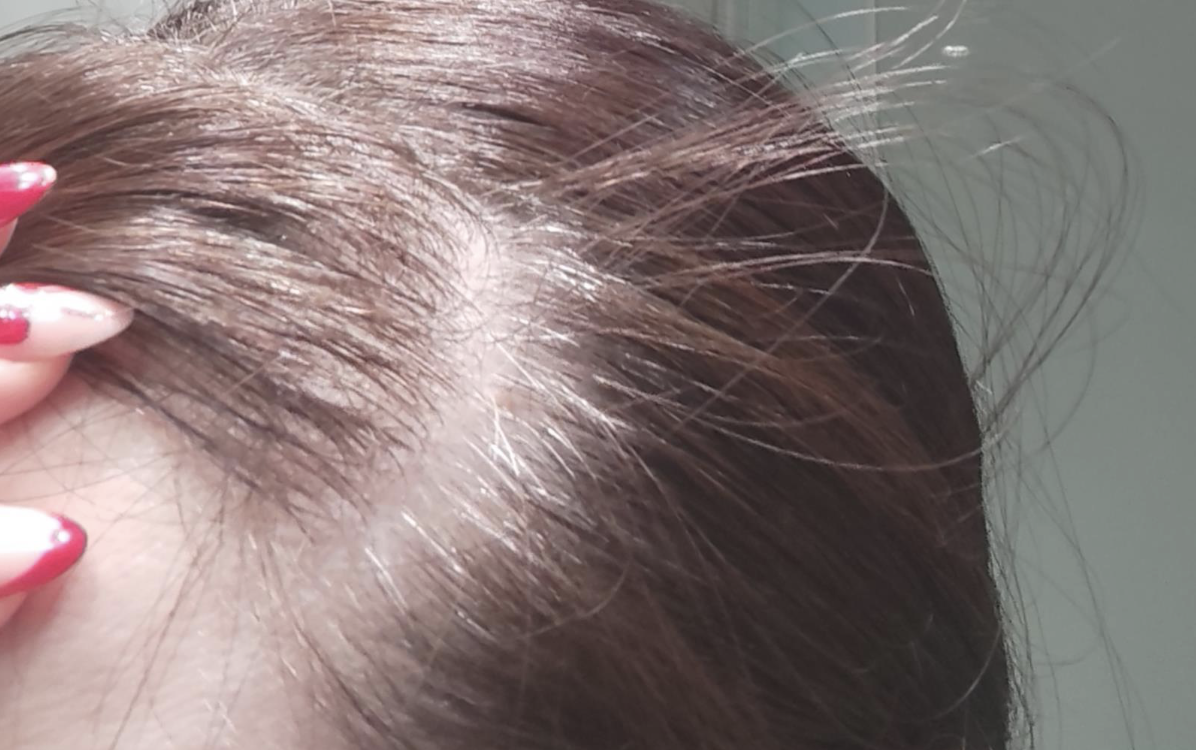 Первые коротыши, из-за которых чуть не обвинили краску для волос 