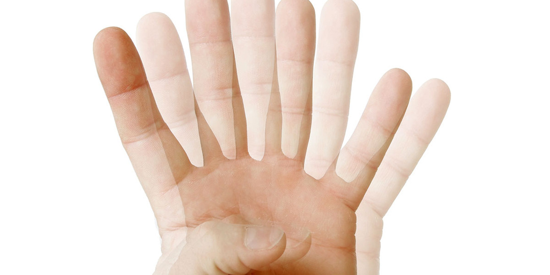 Подарок от инсульта (диплопия).