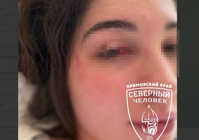 "Это наш брат": брюнет зверски избил девушку за отказ знакомиться