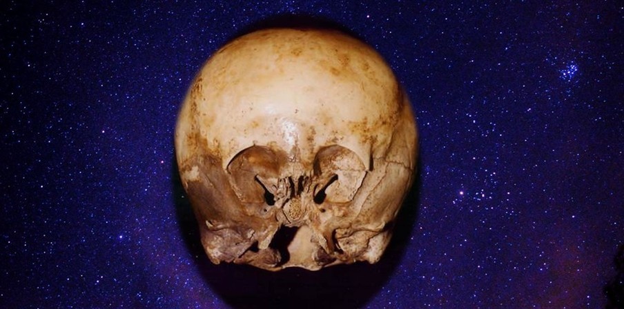 Звездные черепа — это термин, используемый для обозначения аномальных черепов, которые были найдены в различных местах по всему миру. Эти черепа отличаются от обычных человеческих черепов своей удлинённой формой и увеличенным объёмом. Некоторые исследователи считают, что эти черепа могли быть результатом искусственной деформации головы, которая практиковалась в некоторых древних культурах. Однако другие утверждают, что звездные черепа имеют уникальные генетические характеристики, которые не соответствуют известным человеческим видам.