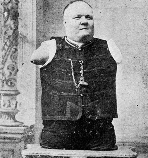 Как русский без рук и без ног стал австрийским миллионером