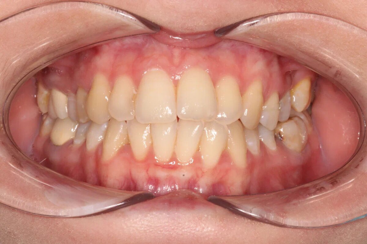 Исходная ситуация