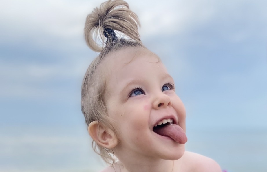 Вываливание языка у ребенка с ДЦП в связи с комплексом нарушений тонуса, глотания, постурального контроля