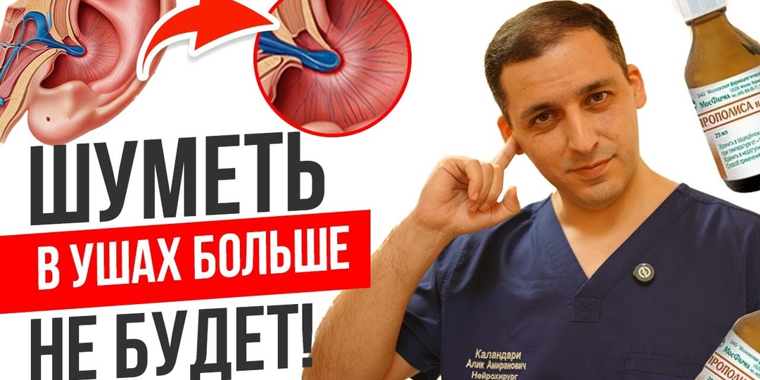 Шум в голове — какие сосуды могут быть причиной