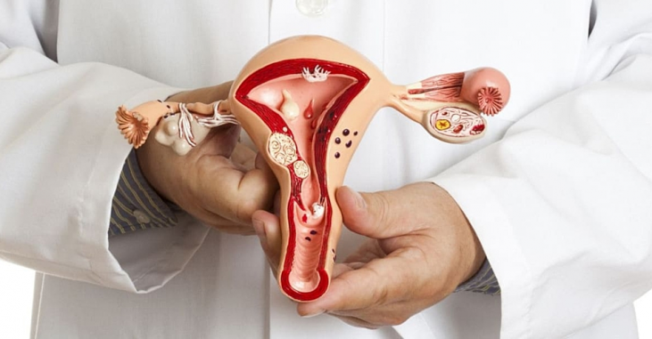 Невидимая боль: почему самую частую женскую болезнь десятилетиями не могут обнаружить