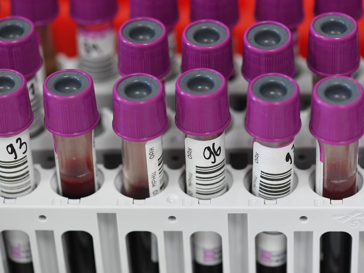    Пробирки с кровью пациентов в лаборатории по исследованию биохимического анализа крови | © РИА Новости / Сергей Пятаков