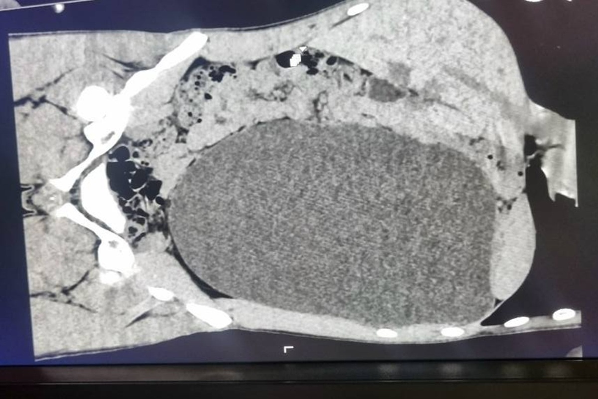    Фото: Минздрав Новосибирской области, источник t.me zdravnso