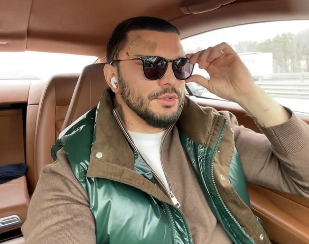    Блогер скрывал лицо за очками после пластики, соцсети