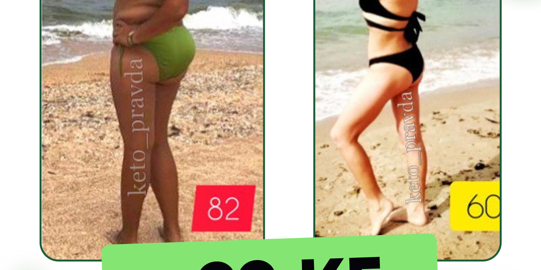 Что произошло с этой женщиной после перехода на кето-питание