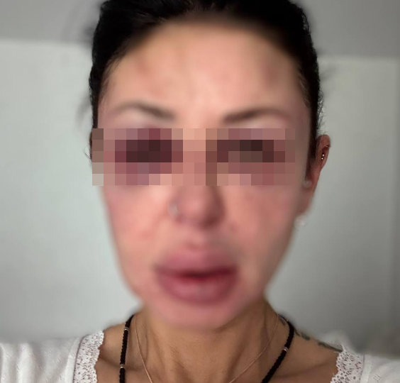 "Такой красавЕцОй будешь": мигрант прислал русской девушке страшное фото, а потом...