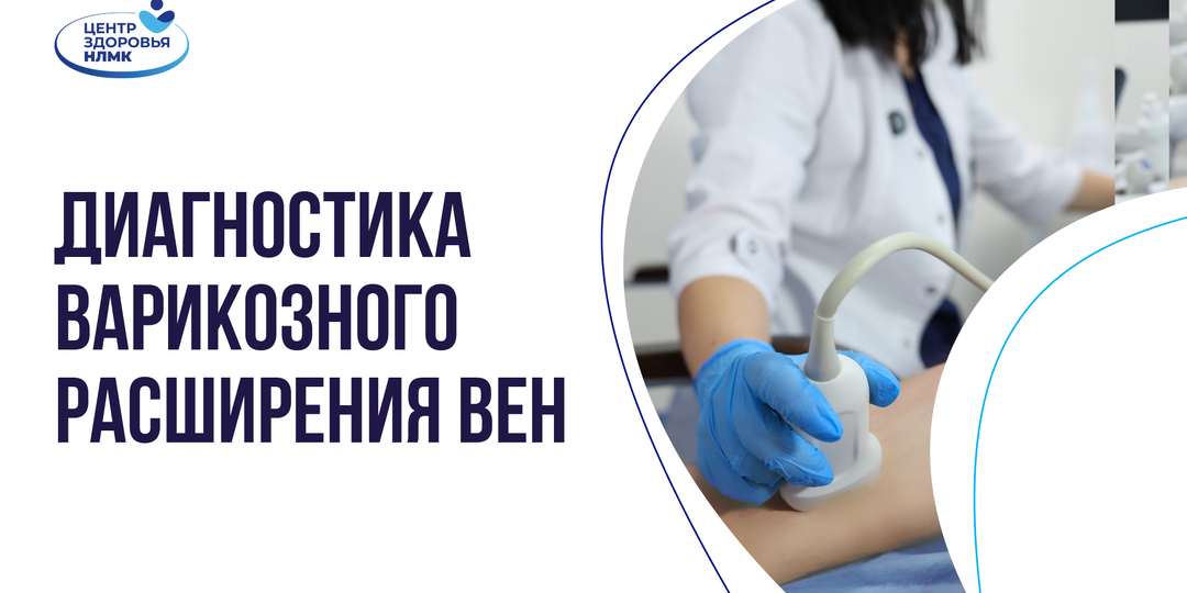 Как распознать варикоз