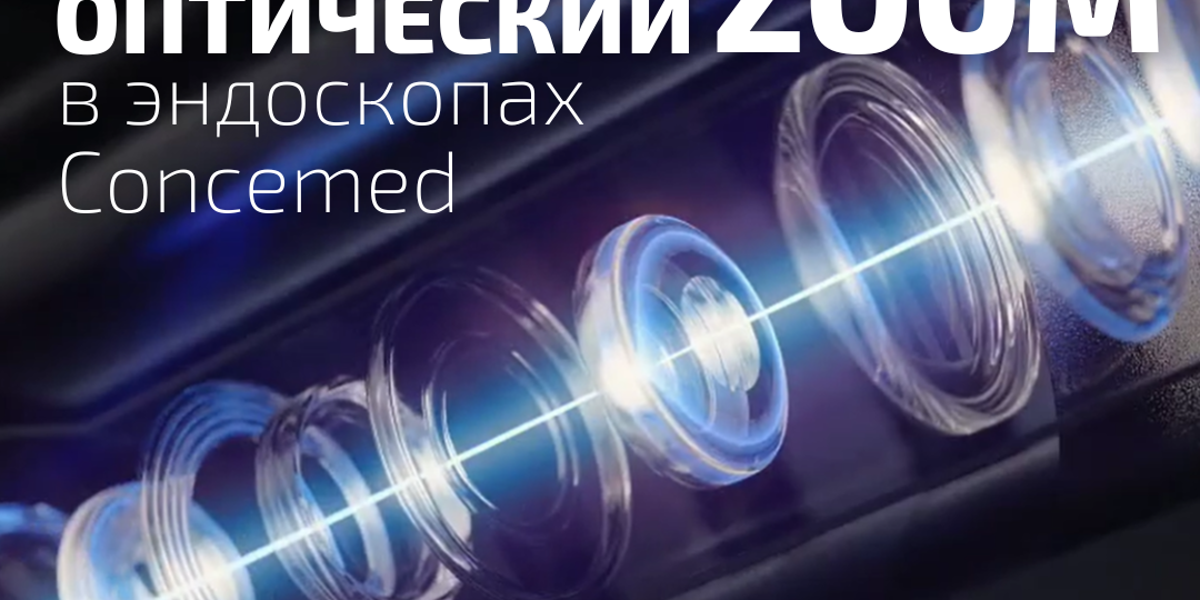 Технология оптического ZOOM от Concemed