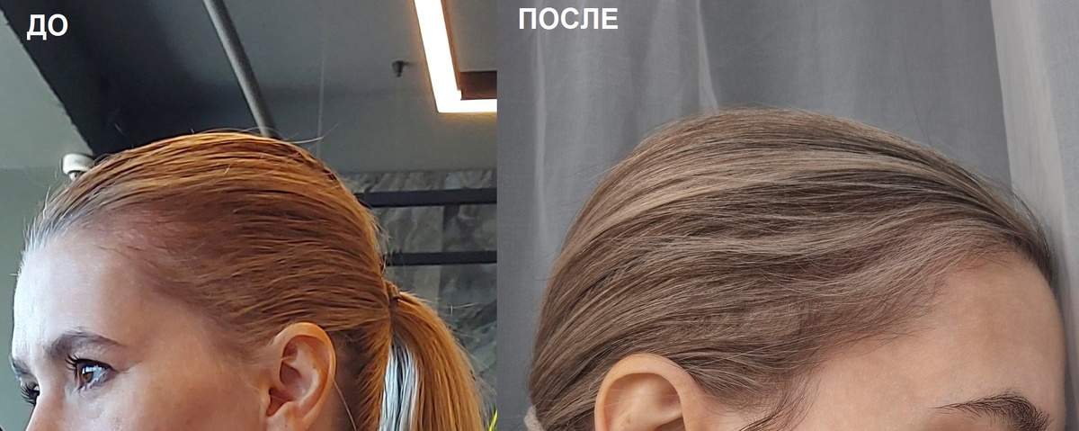 Сторона одна и та же, левое фото сделано на основную камеру, а правое - на фронтальную, поэтому изображение отзеркалено. Левое снято в августе, правое - сейчас, в феврале.