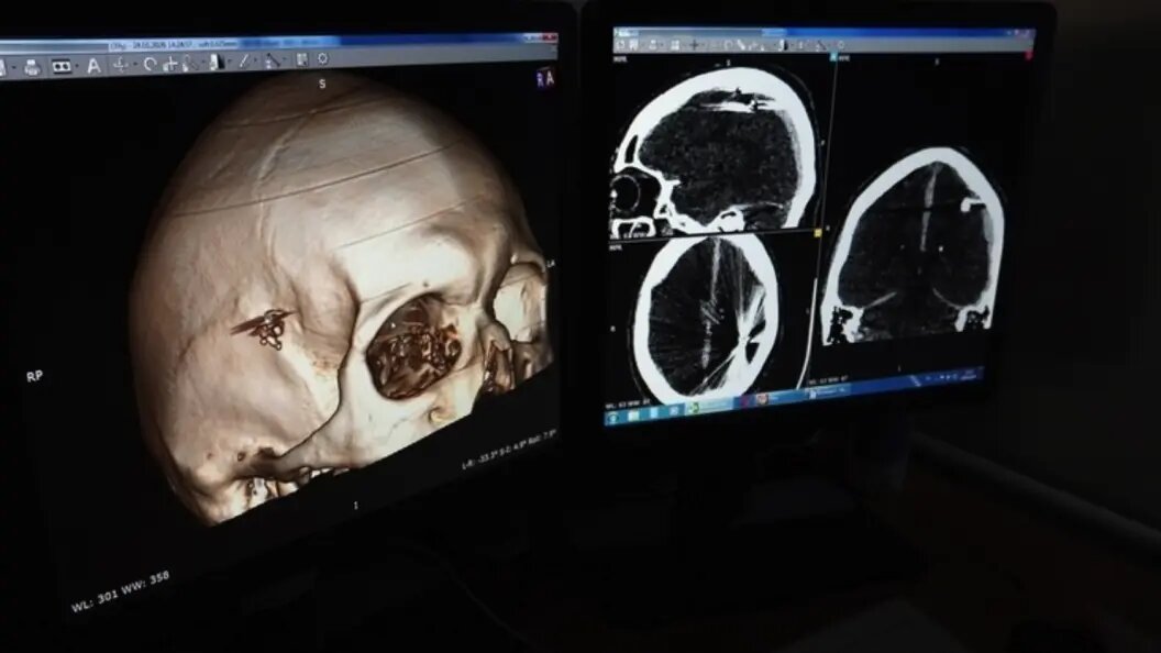    Фото: Краевая клиническая больница скорой медицинской помощи Барнаула.