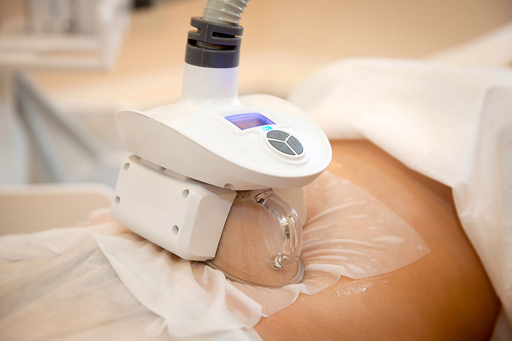 Криолиполиз подходит для точечной коррекции локальных жировых зон и требует предварительной оценки показаний, поскольку не является методом общего похудения.