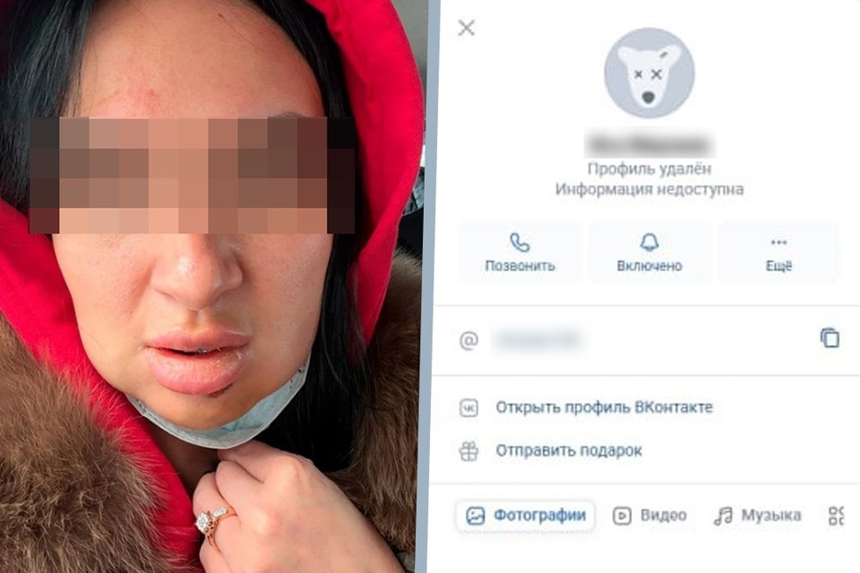    После нападения Анастасия обратилась в полицию, а нападавший удалил страницу в соцсетях. Фото: личный архив/скриншот страницы ВКонтакте.