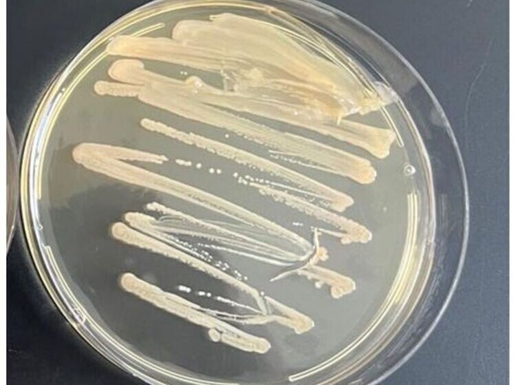 Фотографии из архива лаборатории археологического почвоведения ИФХиБПП РАН, г. Пущино. Клетки древней бактерии Хейндриксия коагуланс.