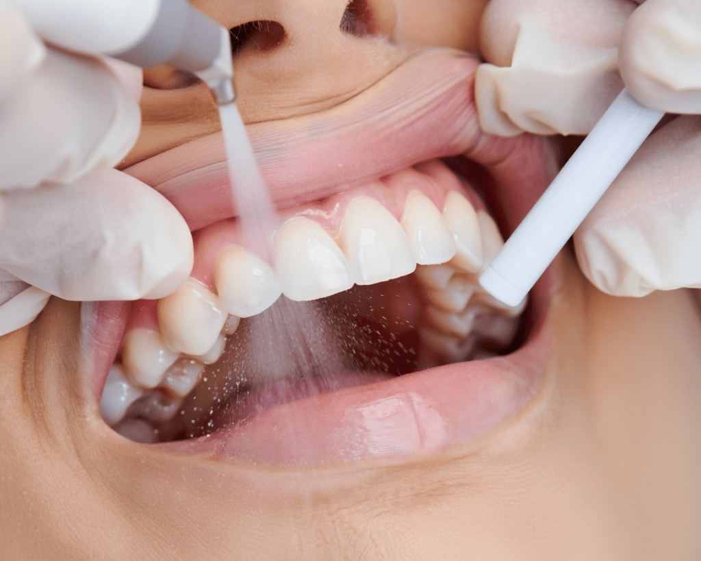 Профессиональная гигиена 