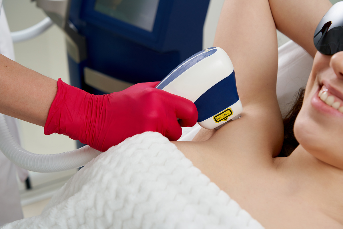 лазерная эпиляция подмышек в городе Ставрополе