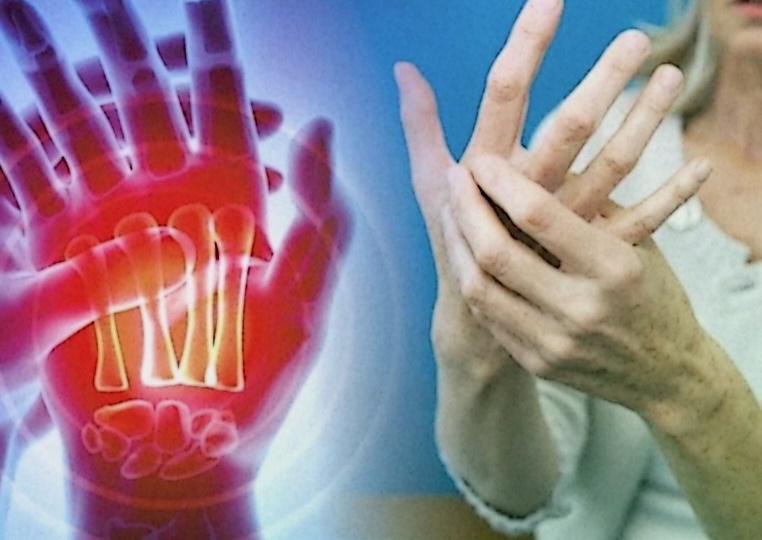 Если у вас ревматоидный артрит: Полное руководство по управлению и улучшению качества жизни