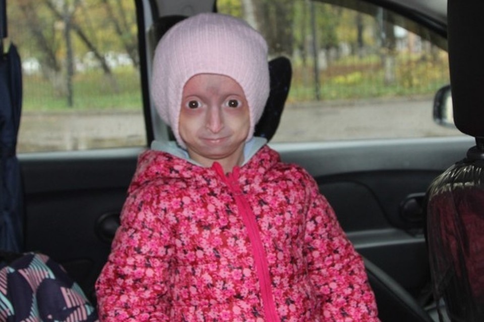    Мелания отличается от сверстников только внешне, внутри она такой же ребенок, как все. Мария ГИЧЕНКО