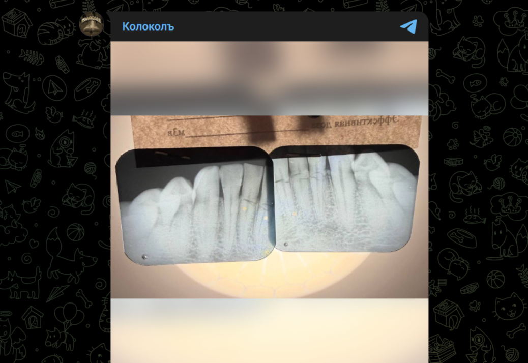 Фото: Telegram-канал "Колоколъ"