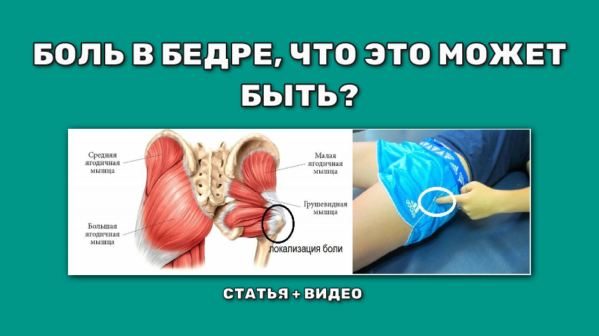 Боль в верхней части бедра сбоку.