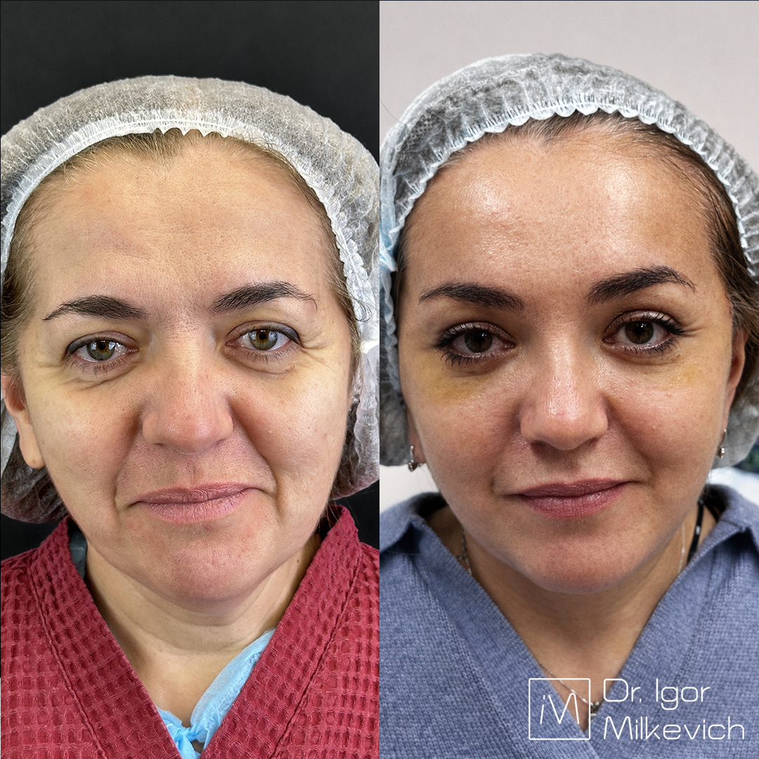 2 недели после операции