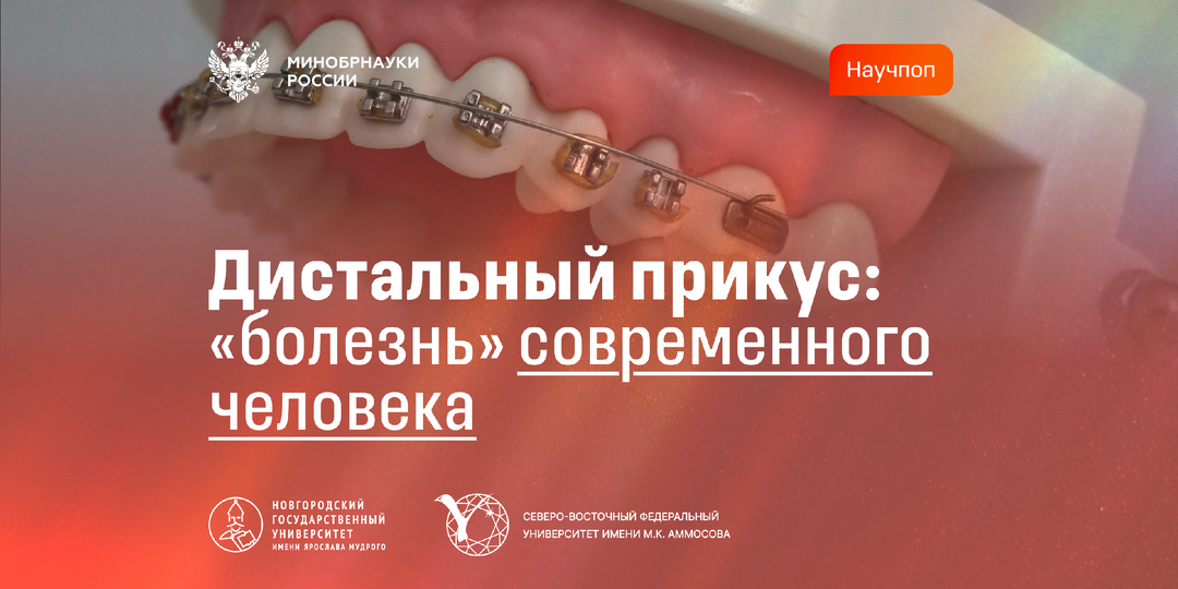 Дистальный прикус: «болезнь» современного человека