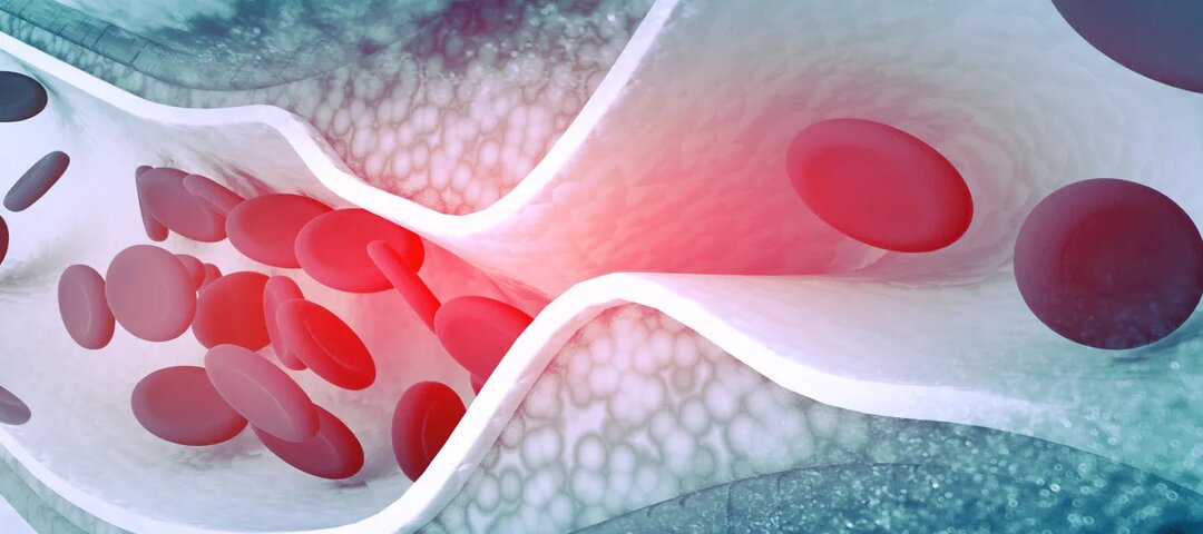 Гомоцистеин: убийца сосудов, о котором вы не знали