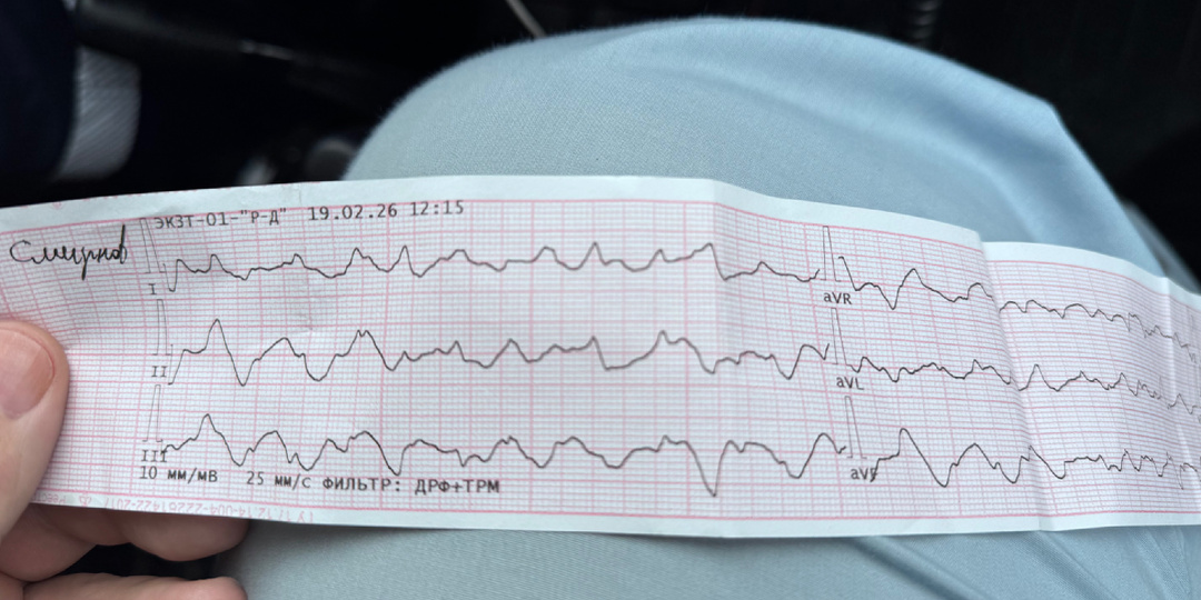Скорая Помощь. Когда реанимация бывает успешной..
