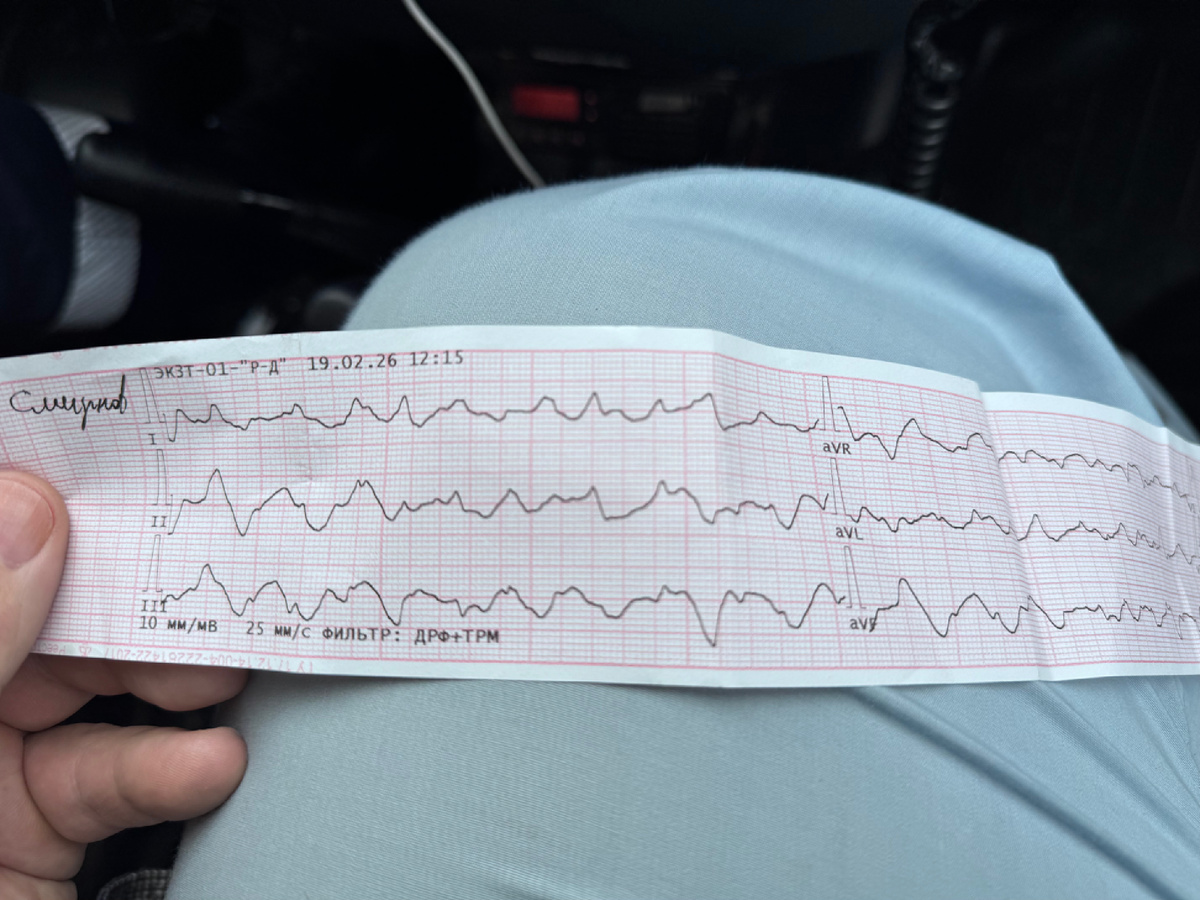 ЭКГ исходное. Это Фибрилляция желудочков 