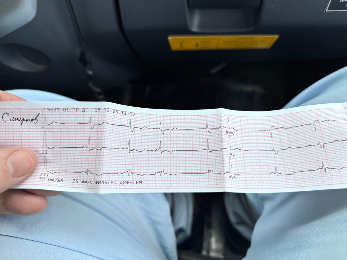 ЭКГ после 20-22 минут реанимации 