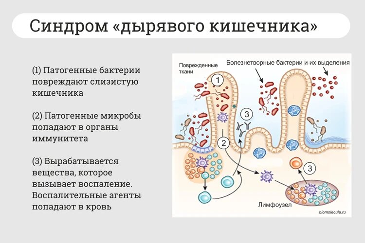 Картинка взята в открытом доступе (Яндекс картинки)