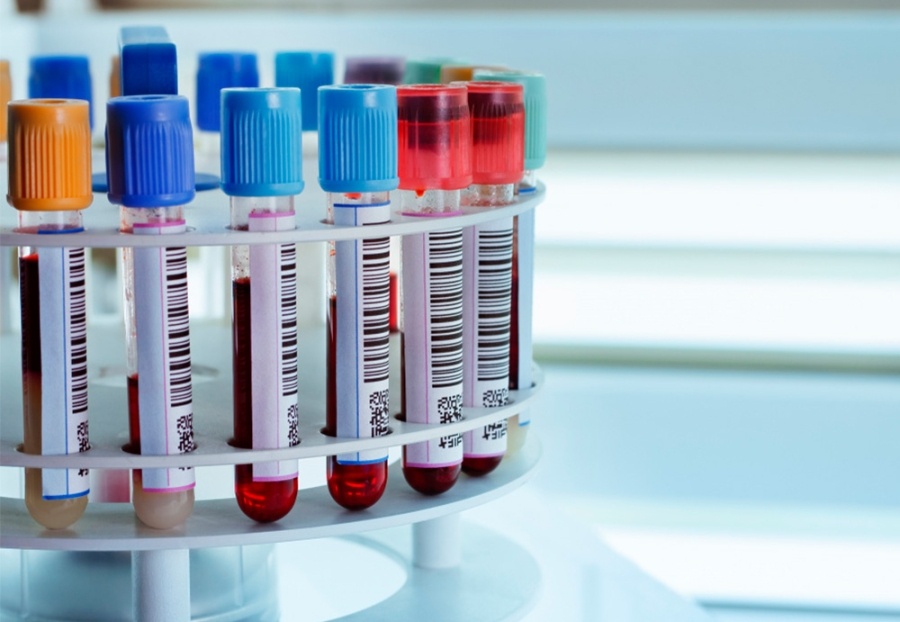     Мифы, страхи и "эффект пинг-понга": главврач Копыльского райЦГЭ о правде про ИППП