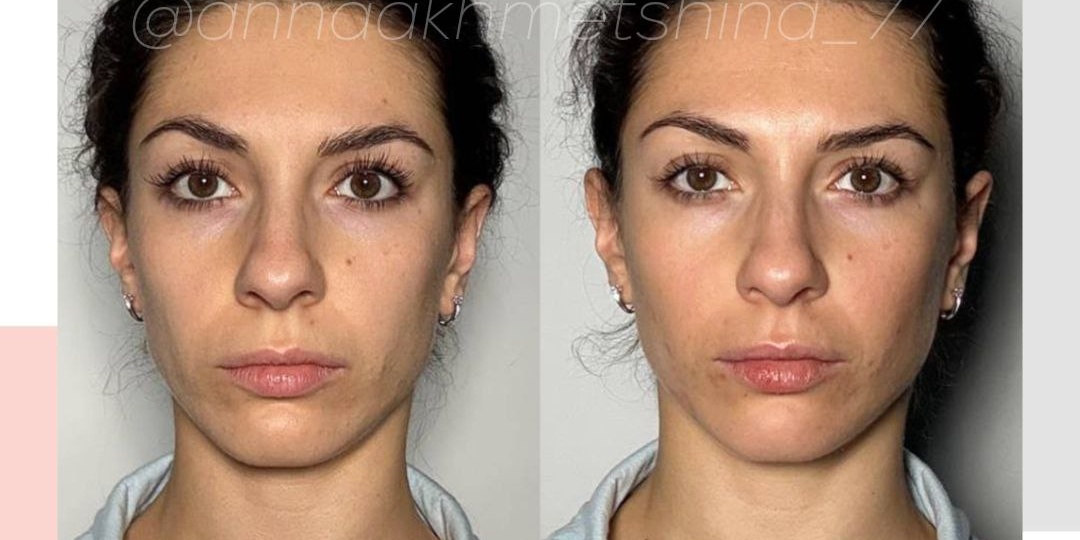 РЕЗУЛЬТАТ АННЫ💛