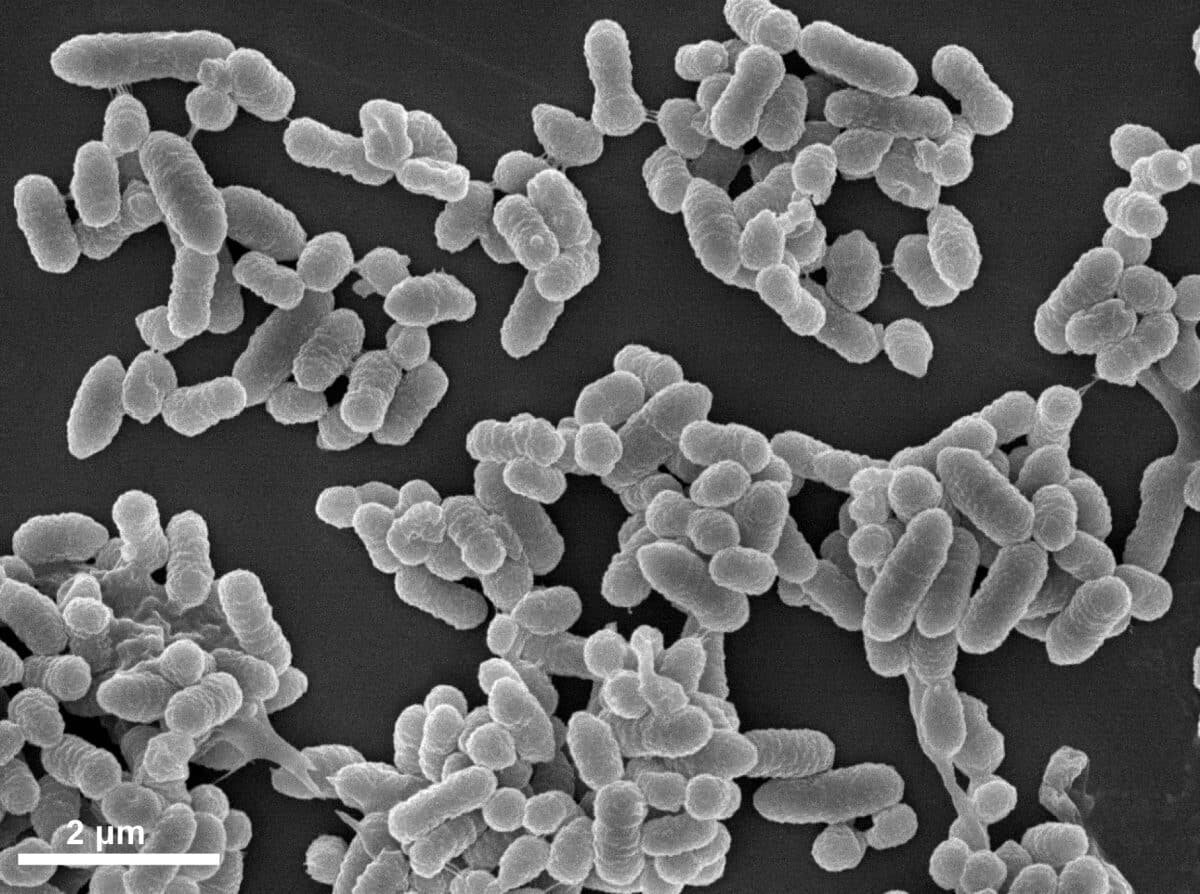   Бактерия Ackermansia biwaensis, способная разлагать муцин / © Yodai Kobayashi et al., Microbiology Society, 2023