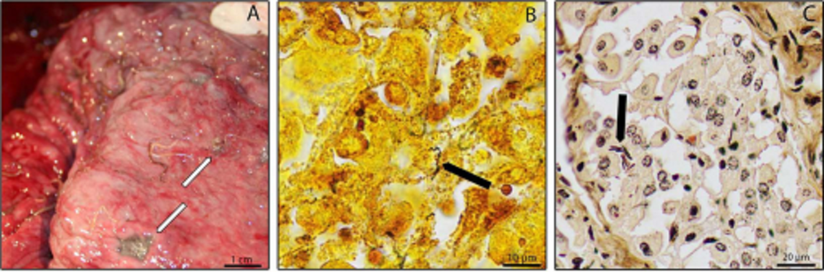    Микрофотографии бактерий Helicobacter из желудков карликовых кашалотов