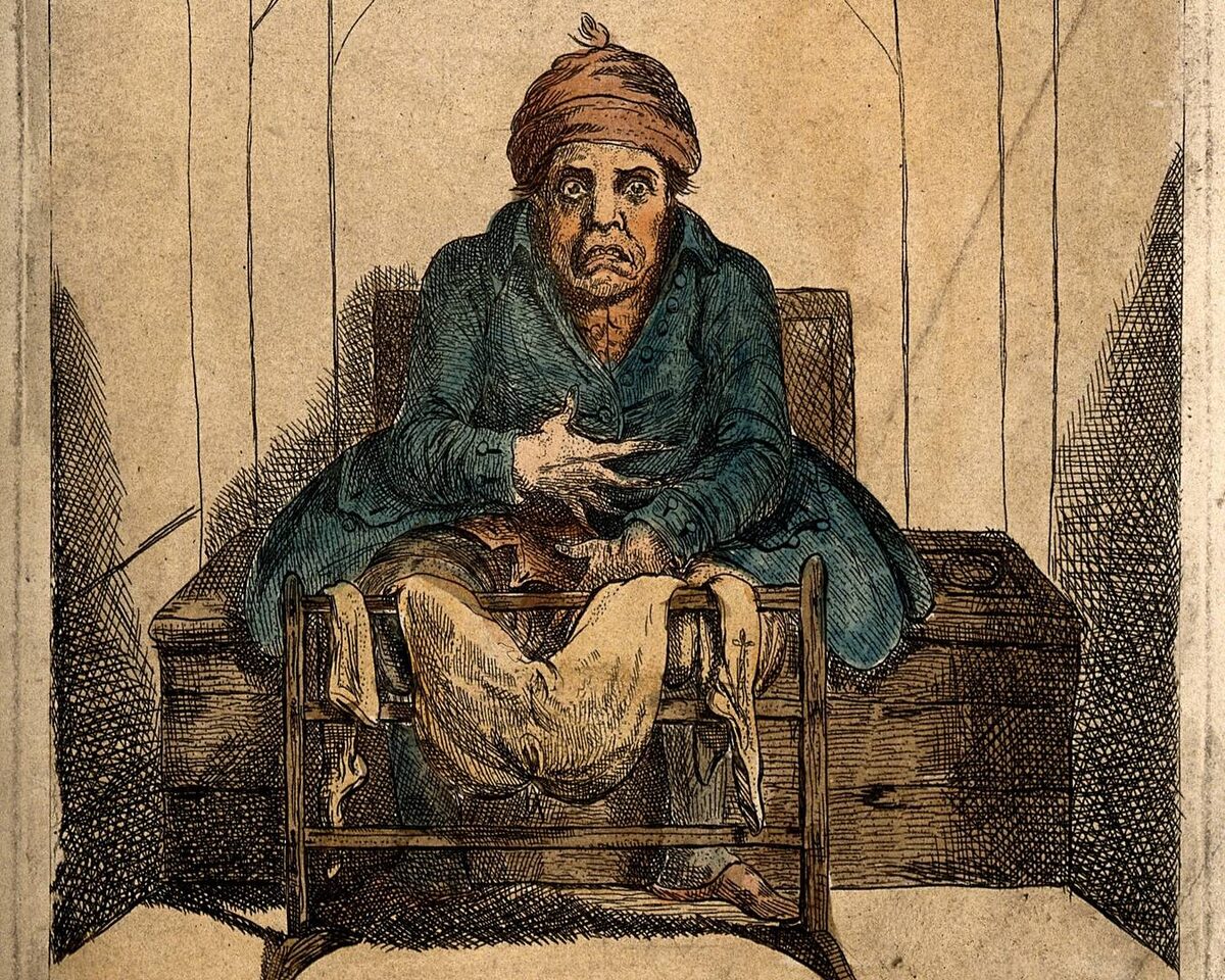     Гравюра Дж. Снейда по рисунку Дж. Гиллрея. Мужчина после приёма слабительного. XIX век   
undefined