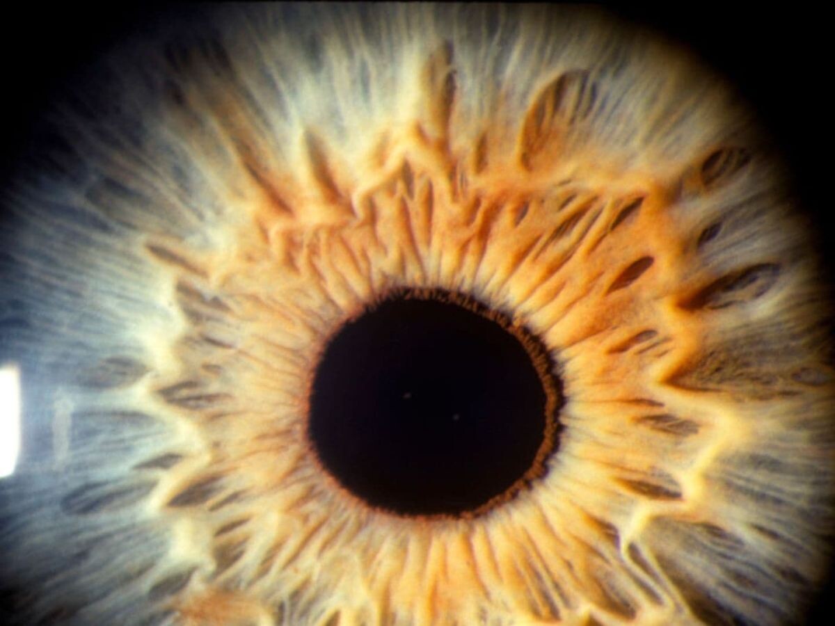    Искуственная сетчатка раскрыла механизм формирования острого зрения