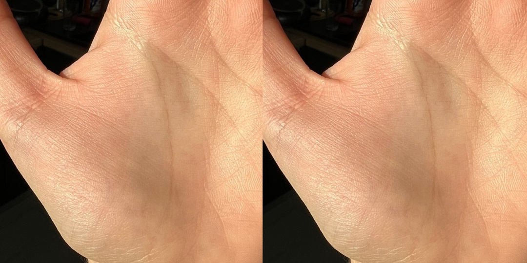 Кольцо Соломона на холме Юпитера. Апекс (трирадиус/трирадий) на холме Юпитера. Хиромантия