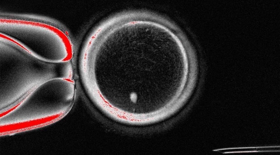 ⚡️ Ученые превратили клетки кожи в яйцеклетки!