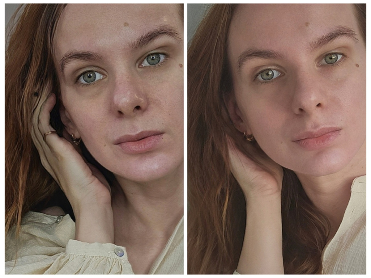 Это вот мое до и после всего одной фототерапии